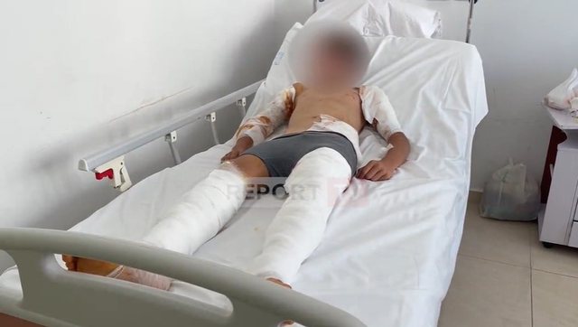 -640-0-1692960180ximituri-834