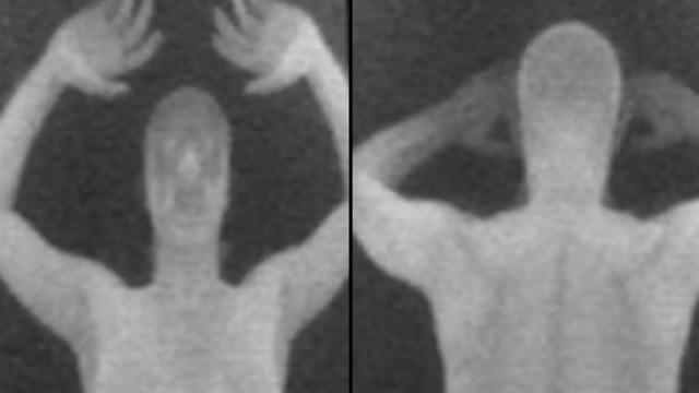 -640-0-skan-1714418366